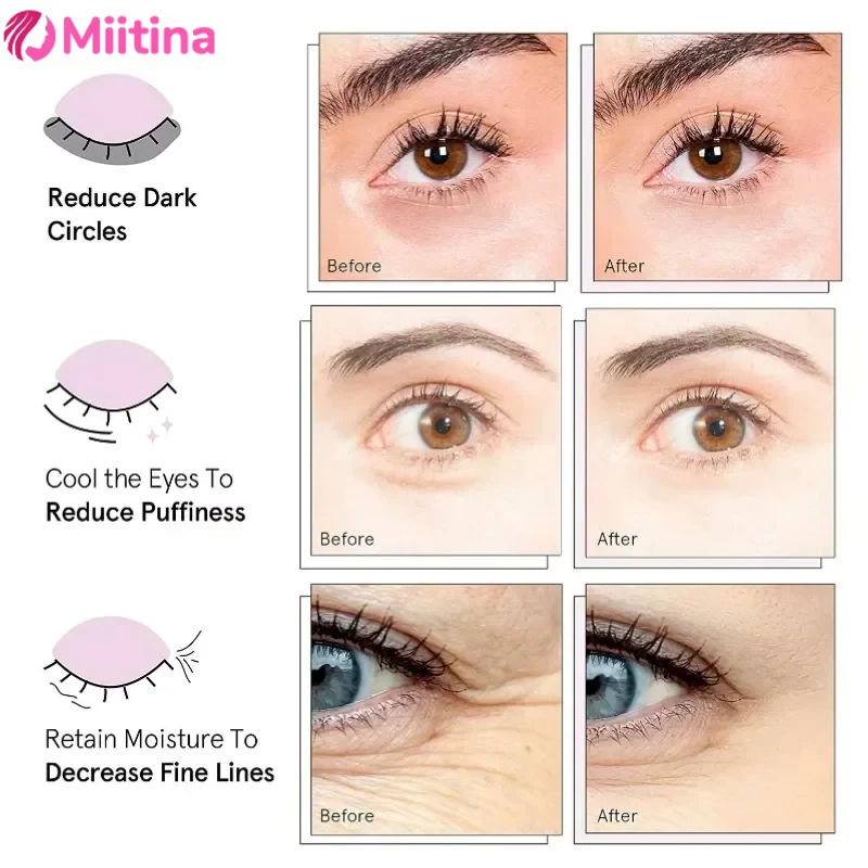 Miitina LED Microcurrent Pulse Eye Massager Relieves Eye Fatigue Fades Dark Circles Wrinkles Heat Treatment Eye Beauty Device eye massager