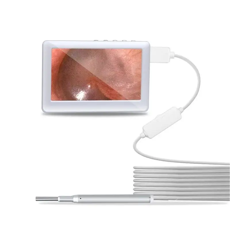 Generic Nettoyeur d'oreille,nettoyeur d'oreille avec caméra,otoscope  endoscope,USB 1080p à prix pas cher