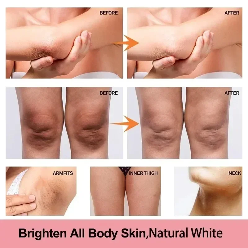 Effective Brightening Body Cream Armpit Legs Knee Elbow Bleaching Cream For Dry Skin Knuckles Lighten Dull Hand Skincare 4 size 6