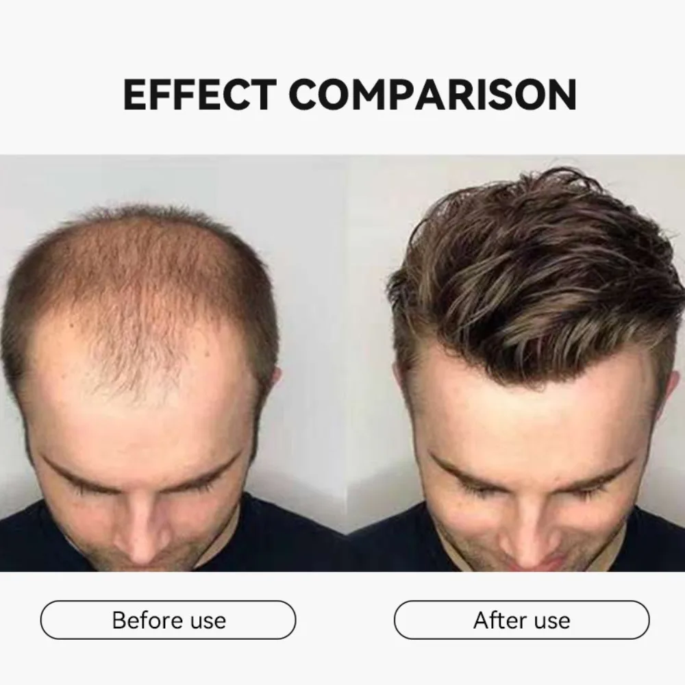 Hair Serum Gentle Nourishes the Scalp and Cares for the Softening Hair Care Daily Care Scalp Serum. - 6