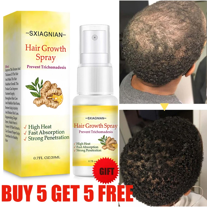 

Ginger Fast Hair Growth Serum Spray Regrowth Oil Products Anti Hair Loss Products Prevent Baldness Scalp Treatment Beauty Health