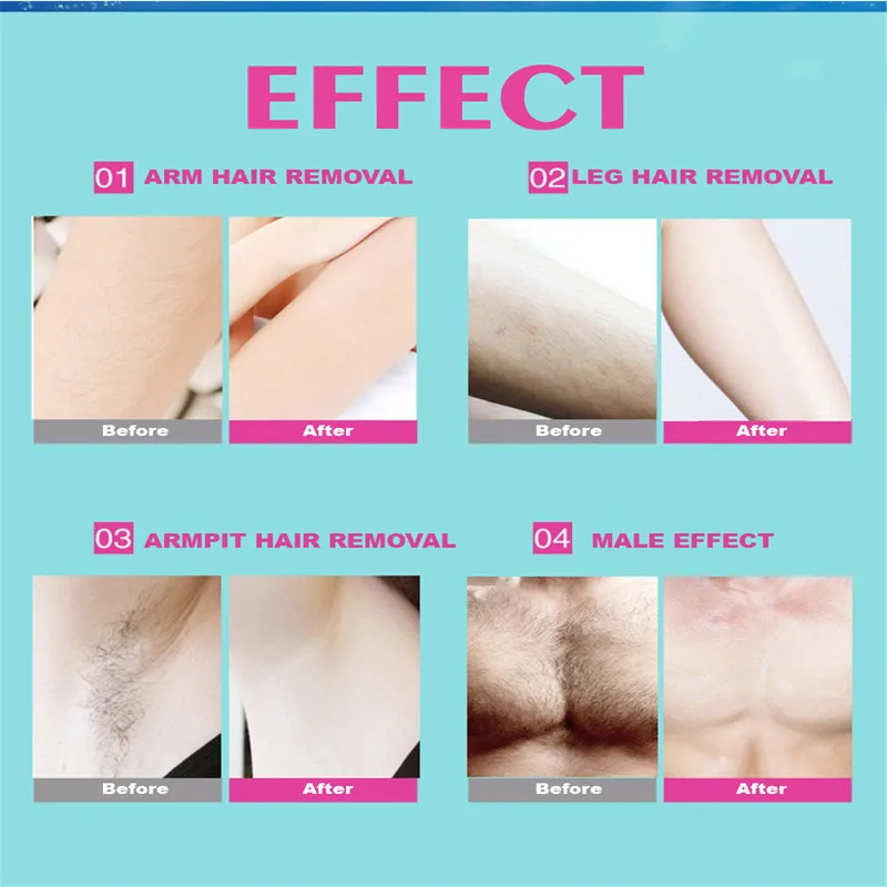 10 pezzi/lotto Strisce depilatorie in tessuto non tessuto per epilazione, patch epilatori per viso/gambe/zona bikini_voghion.com