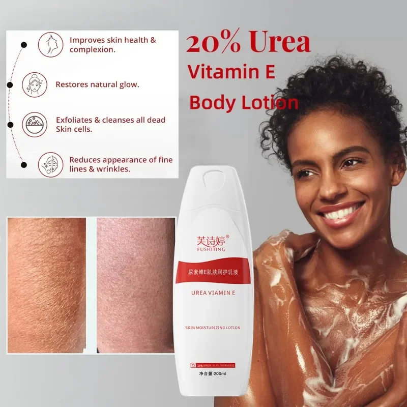 

Extreme Dry Repair Advance Therapy 20% Urea Vitamin E Body Lotion Eczema Psoriasis Cream Rough Dry Skin Moisturizer Foot Care
