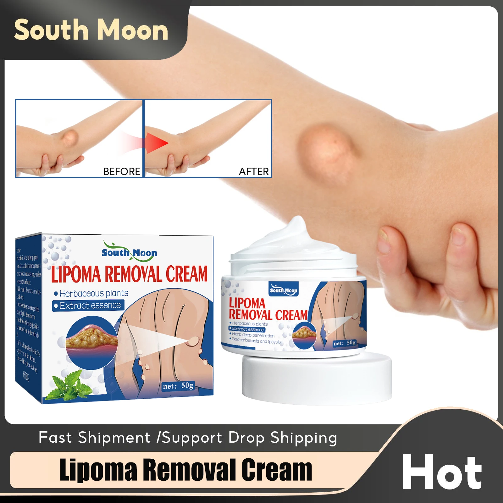 Kit 6 Strumenti Rimozione Copribulloni Cerchi - Per Auto Senza Graffiare - Foto 4