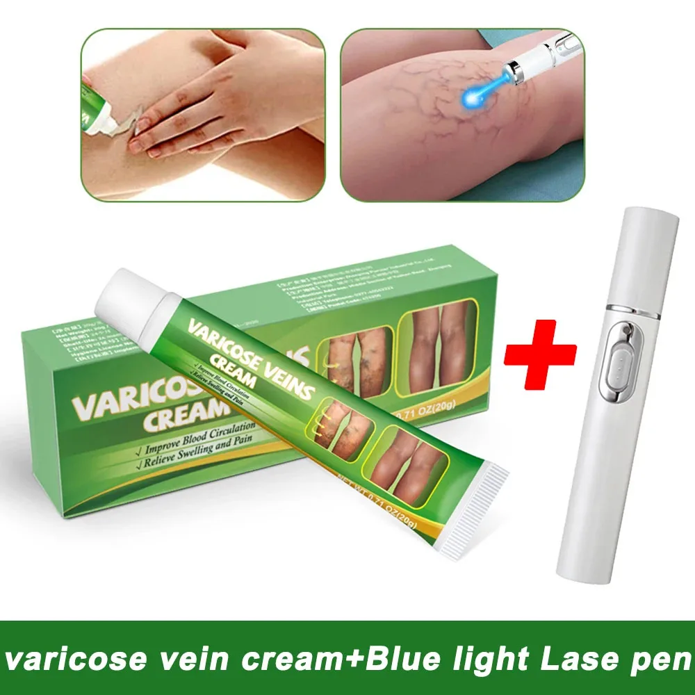 Varicose Veins Laser Treatment Cream Effective Relieve Legs Dilated Vasculitis Phlebitis Natural Formula Ointment Varicose Veins