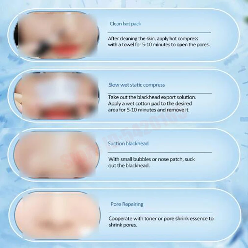 Nose Blackhead Peeling Solution Serum Facial Cleaning Liquid Scrub Special Solution Skin Deep Cleaning For Small Bubble 3