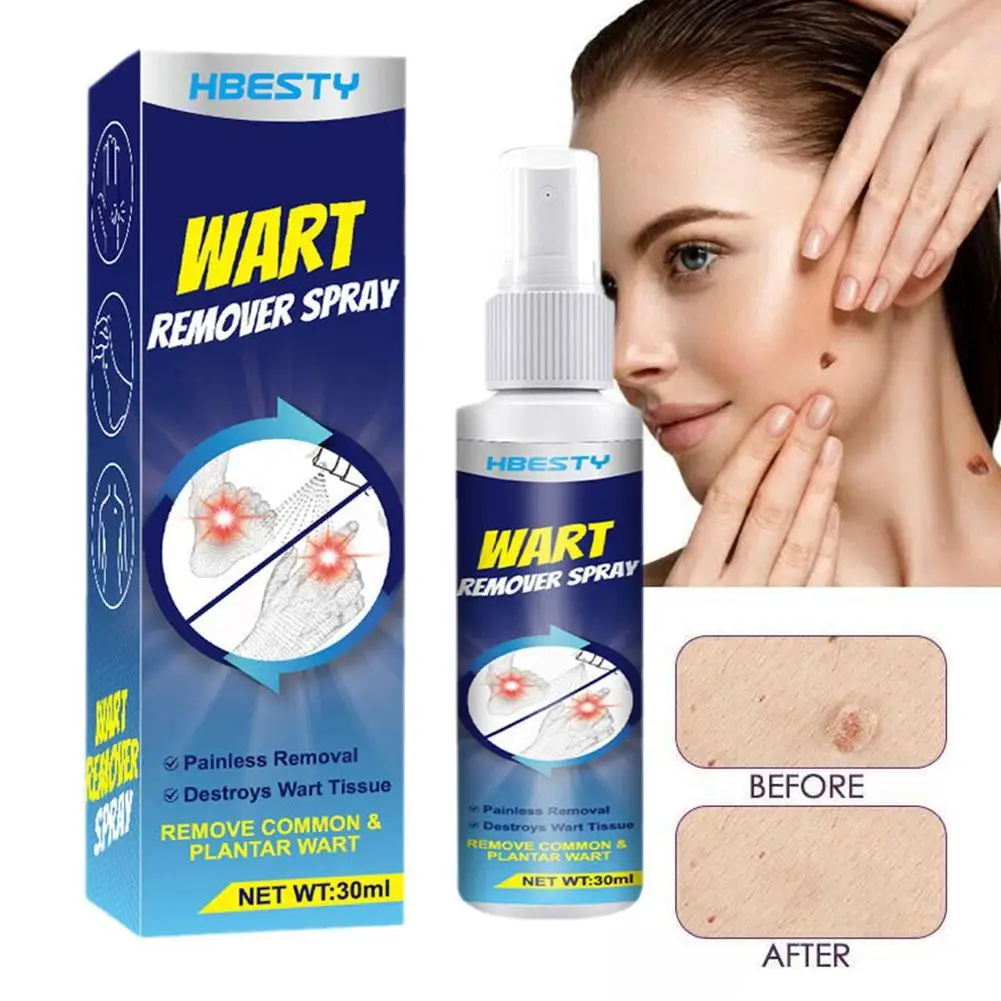 

30ml Skin Tag Remover Spray Painless Mole Skin Dark Spot Warts Repair Essence For Body Wart Removal Personal Health Care Spray