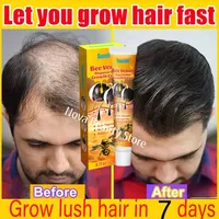 Hair Growth Cream 7 Days Fast Regrowth Essential Capsule Anti Hair loss Baldness Repair Damaged Scalp Treatment For Women Men