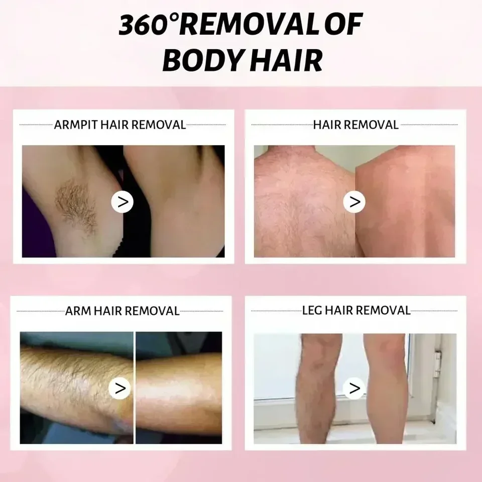 Permanent Inhibition Serum Painless Allantoin Lupine Essence Remover Hair Growth Inhibitor Depilatory Body Cream Care_voghion.com