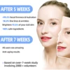 West Month 2MLx7PCS Reyouth Anti Ag-ing Essence Ampoule, Hyloranic Acid Hyaluronic Acid Essence Moisturizing Essence Ampoule Set 3
