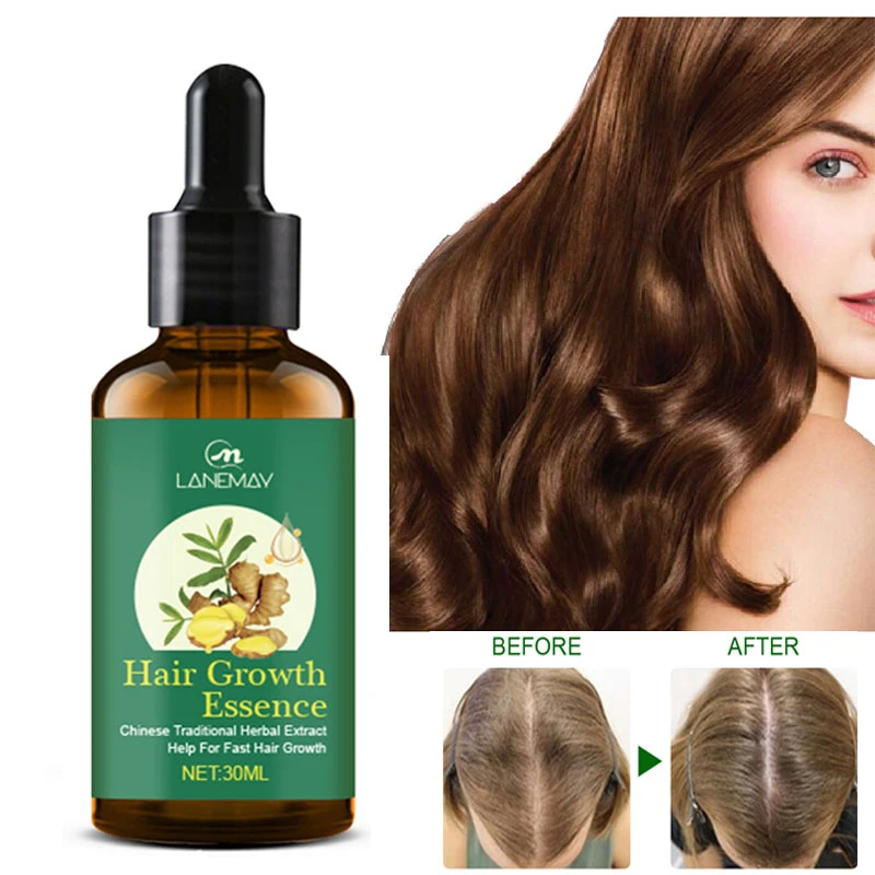 Ginger Hair Growth Essential Oil Prevent Hair Loss Fast Growing Repair