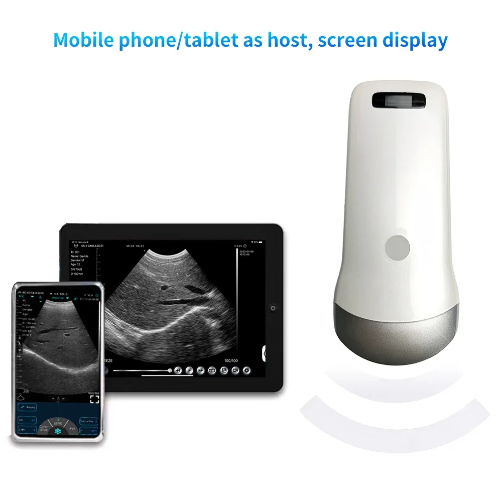 Portable Wireless Ultrasound Convex Probe Scanner Machine with Aluminium Box Support IOS Android Windows