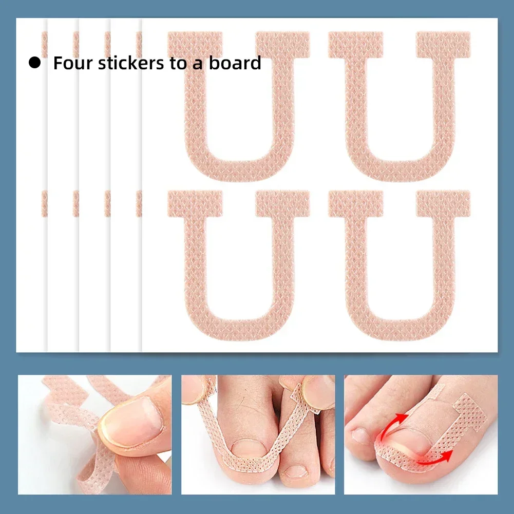 Nail Correction Stickers Ingrown Toenail Corrector Patches Treatment Recover Corrector Pedicure Care Tool 4Pcs/Sheet