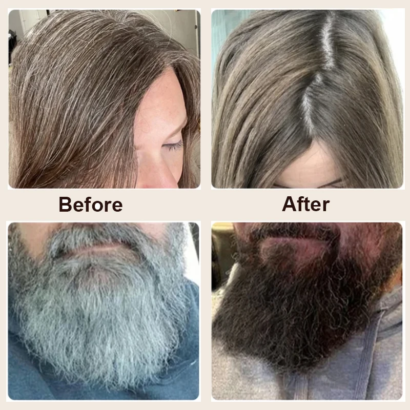 Anti Gray Hair Essence Hair Blackening Serum Treatment for White Hair Repair Care Nourish Scalp Anti Loss hair growth serum