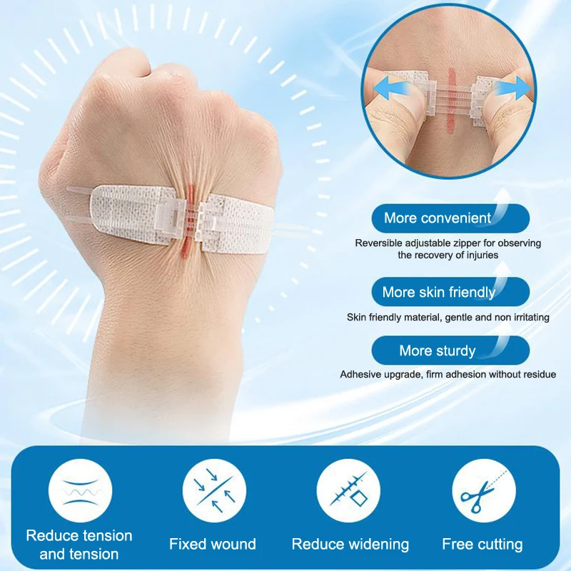 Portable Zipper Tie Wound Closure Patch Hemostatic Patch Wound Fast Without Suture Zipper Outdoor Band-Aid Quick Clot