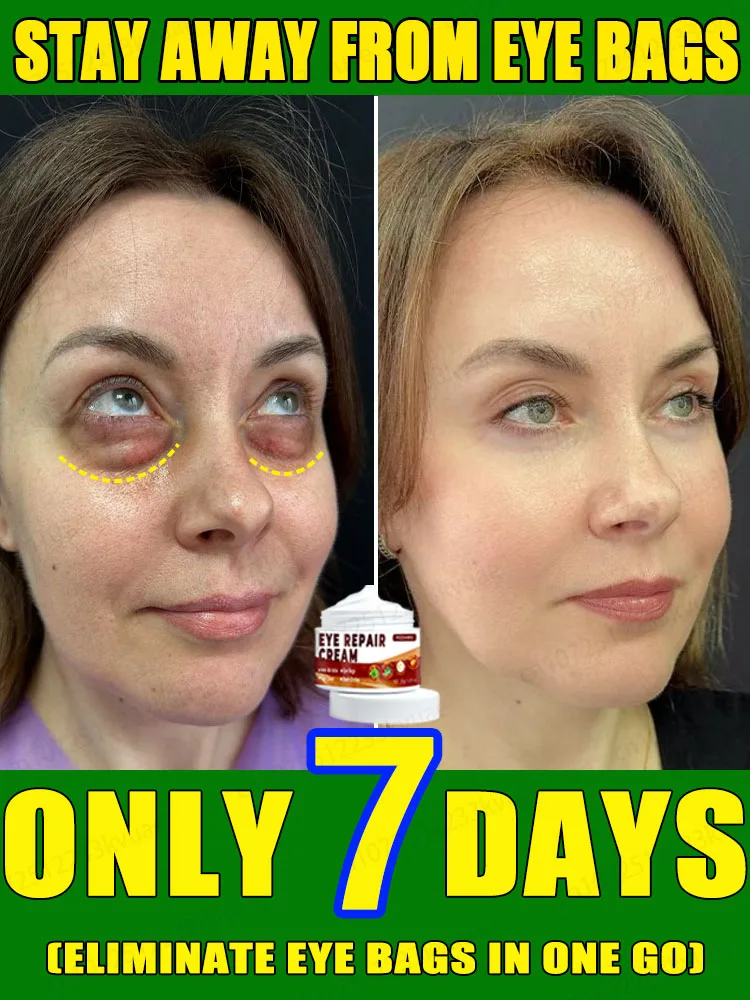 Eye Bag Killer Eliminates 99.9% of eye bags with centella asiatica and aloevera extracts to improve the skin around the eyes