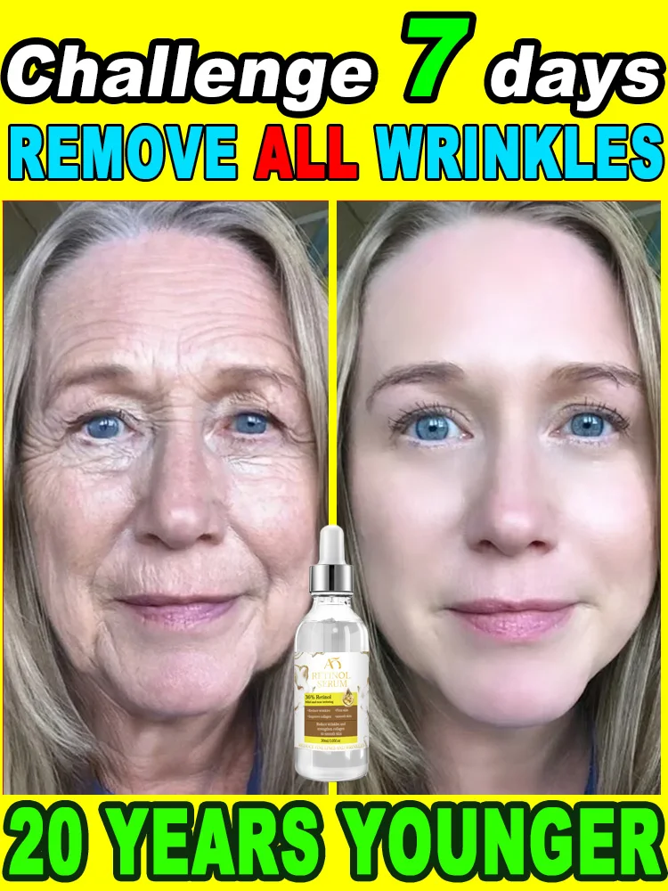 wrinkles disappear become beautiful now 1