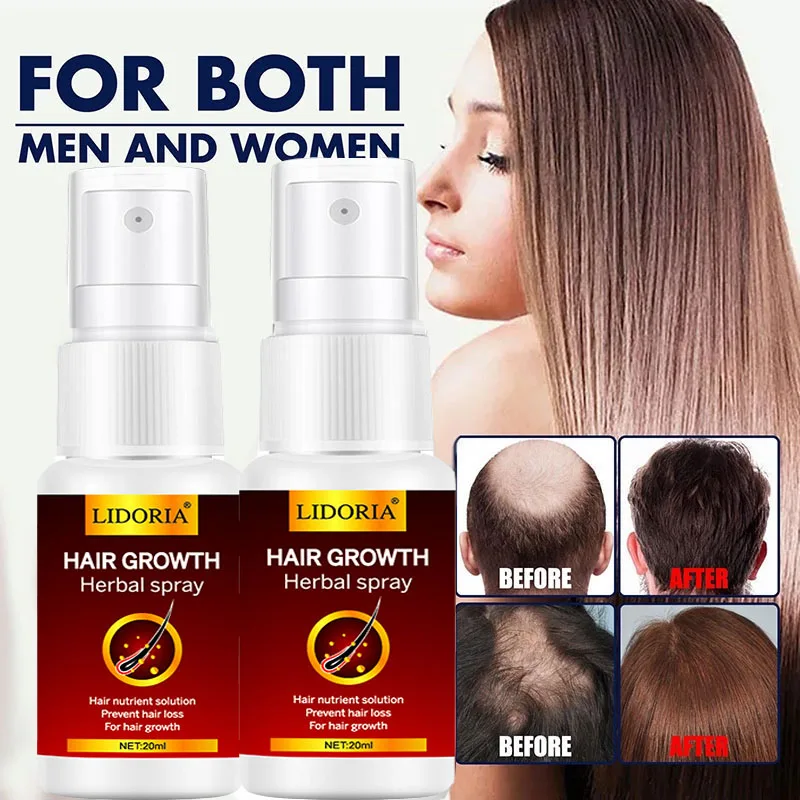 Hair Growth Serum Spray Fast   Liquid Treatment Scalp  Follicle Anti  Loss Natural Beauty Health  Care