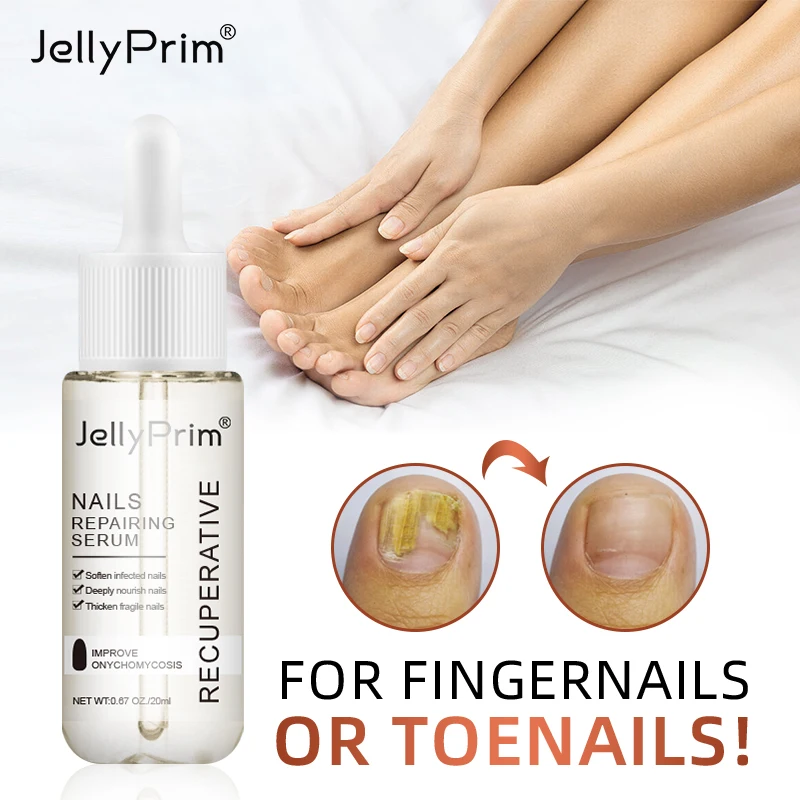 best nail fungus treatment