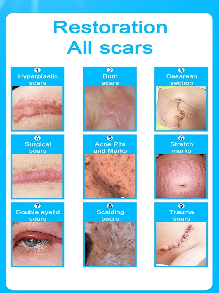LASER SCAR Potent delete 4