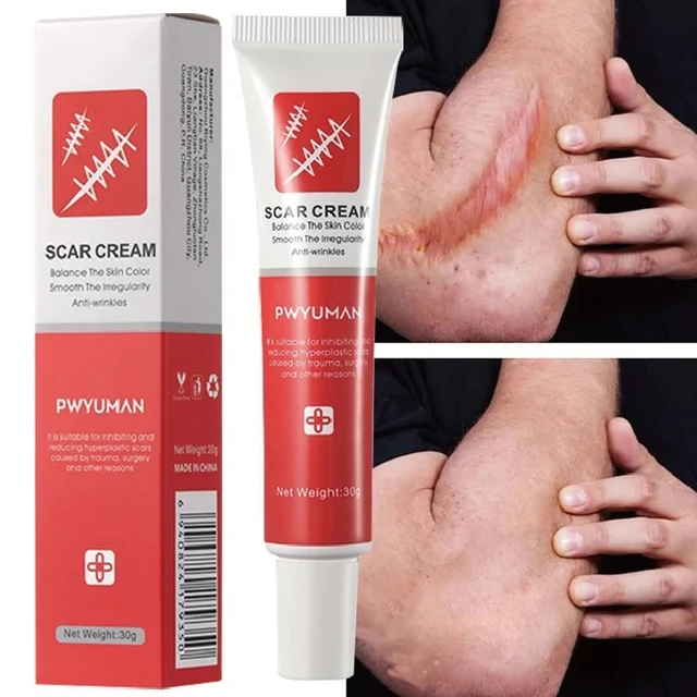 BNF 30G Scar Removal Cream For Face Body Cuts Scar Stretch Marks Natural  Formula Price in India - Buy BNF 30G Scar Removal Cream For Face Body Cuts  Scar Stretch Marks Natural