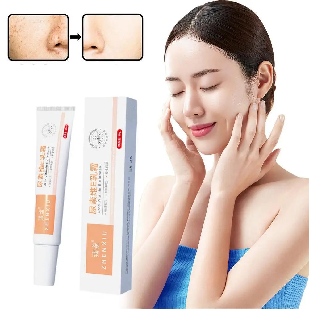 

Vitamin A/E Body Lotion Whitening Brighten Fade Hydrating Acne Skin Moisturizing Wrinkle Remove Skin Smooth Chicken O0P8