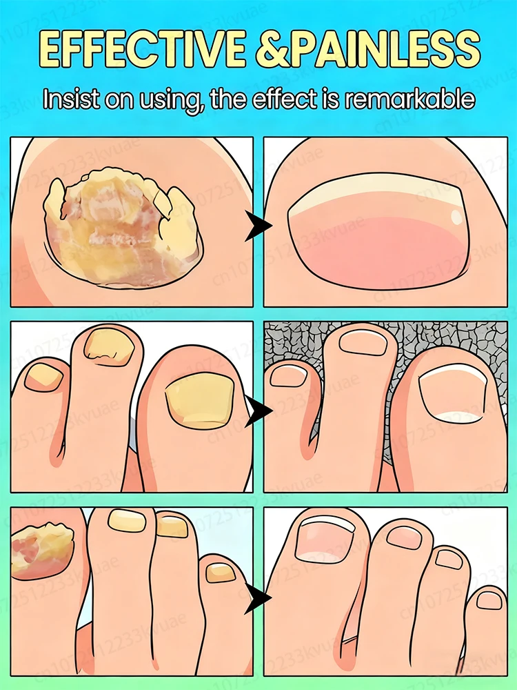 2026년 히트 상품. 네일 아트용 라스터 데코레이션. 재발 없음.