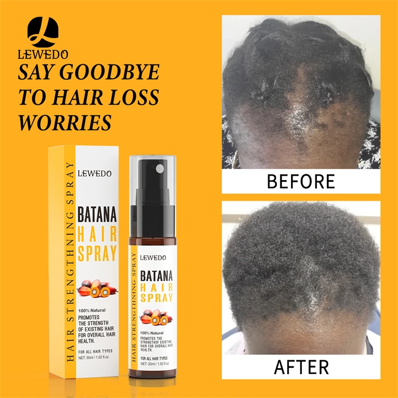 30ml Hair Growth Spray Traction Alopecia batana Hair Essence Repair Damaged Care Serum Anti Break Oil hair treatment oil hair treatment