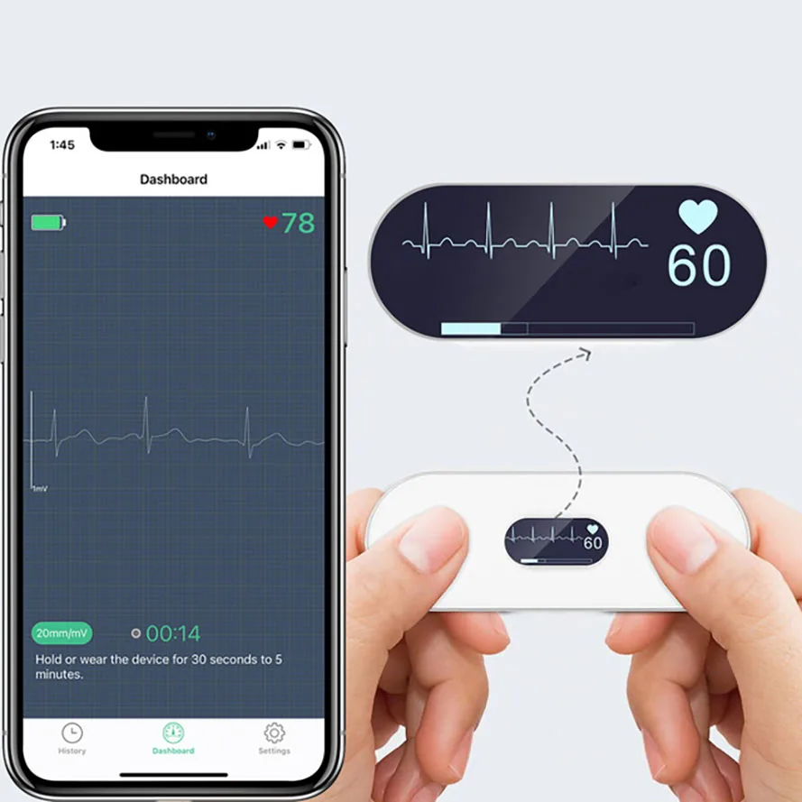 Portatile Oled Bluetooth Ecg Holter Monitor Ecg Cardiaco Monitoraggio Del Cuore Archiviazione Dati E Condivisione Elettrocardiogramma Indossabile