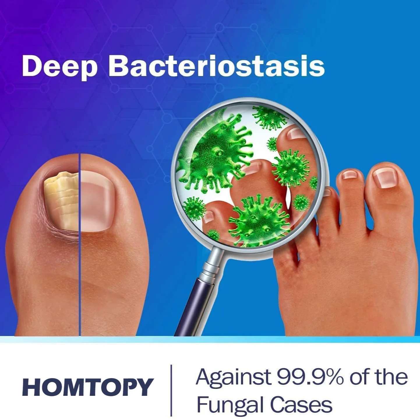 قلم إصلاح فطريات الأظافر، سائل لفطريات الأظافر، ال...