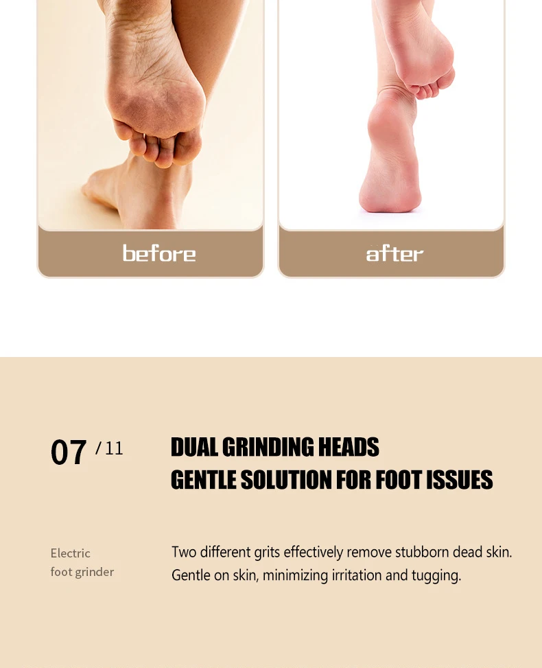 Râpe électrique pour les pieds dissolvant callosités pédicure_voghion.com