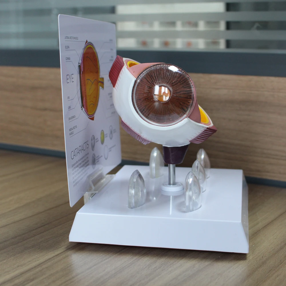 Cornea Eyeball Model Human Eye Demonstration Glaucoma Cataract Anatomy Medical Teaching Tool