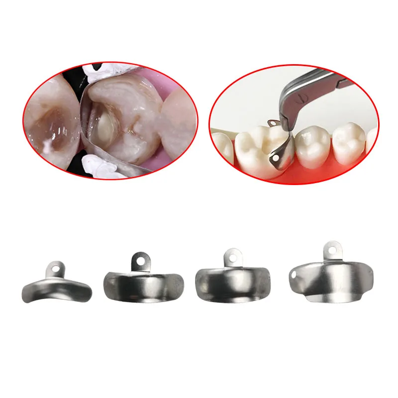 50100PcsDentalMatrixBandsSectionalContouredMetalMatricesMatrixBandsForTeeth