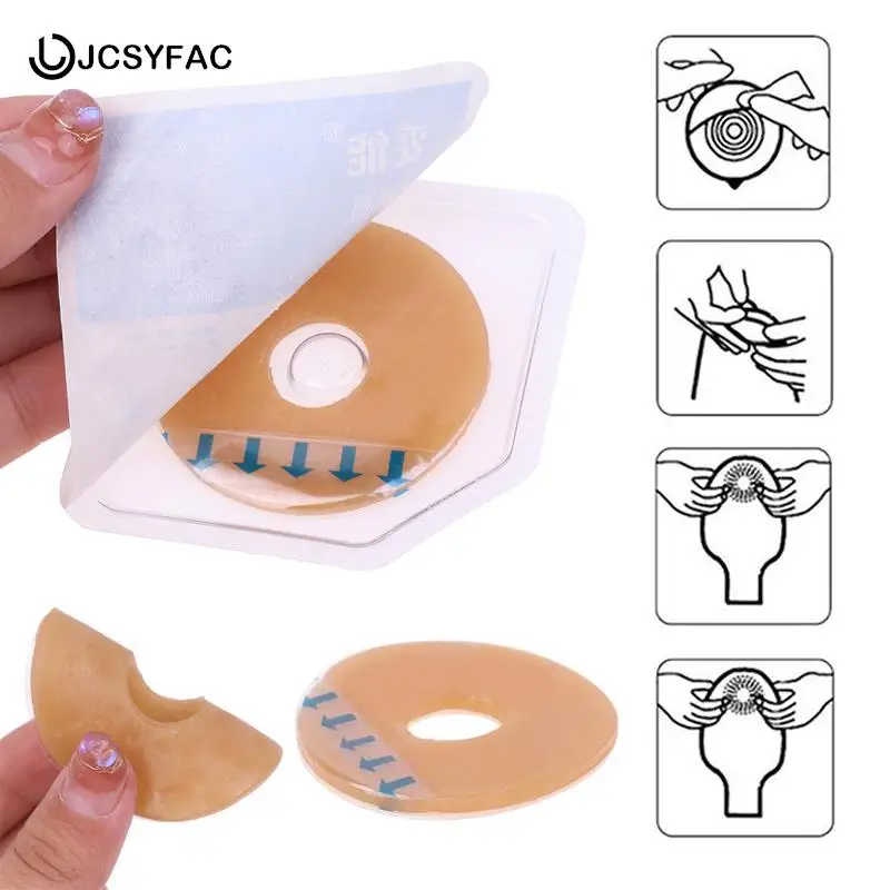 1PCSOstomyPasteRingBaseplatesStomaCareLeakproofRingForOstomy