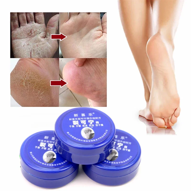 Traditional Chinese 33g Oil Anti-Drying Crack Foot Cream Heel Cracked Repair Cream Removal Dead Skin Hand Feet Care Feet Care