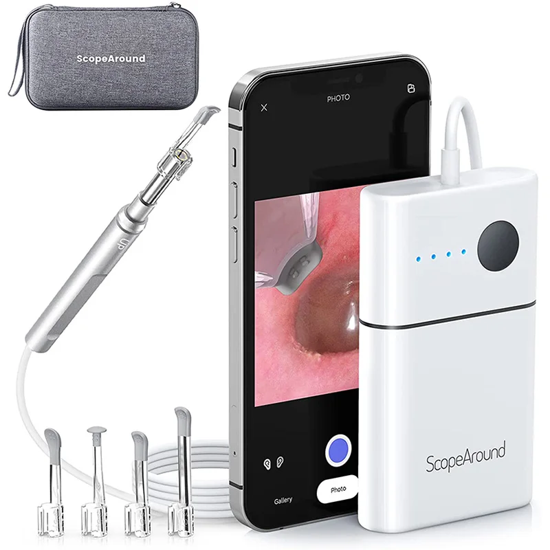 Scopearound Ear Camera, Otoscope With Light, Ear Endoscope And Ear Wax