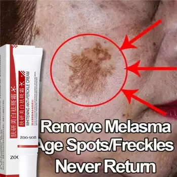 Powerful whitening cream for stain removal Lights the skin quickly eliminates melanin pigmentation Melasma Dark spots Korean skin care 1