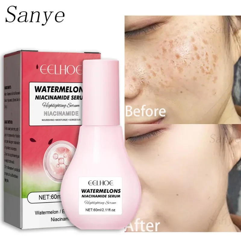 

Watermelon Niacinamide Serum Face Whitening Moisturizing Freckle Essence Lighten Acne Brighten Serum Women Facial Skin Care