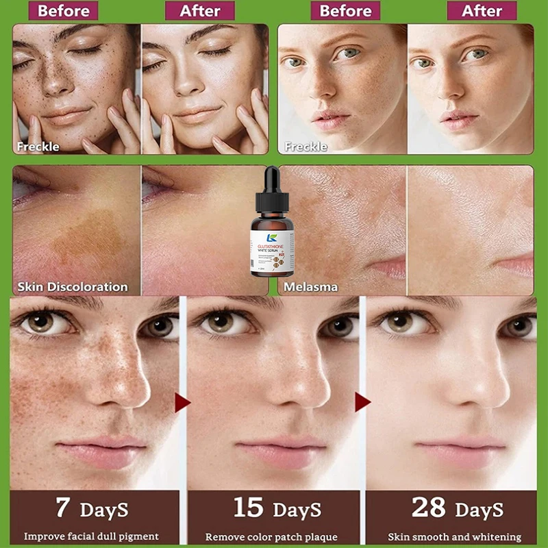 Whitening Serum Fade Dark Spot Freckle Brighten Essence Remove Pigment Melanin Correcting Beauty Face Skin Care