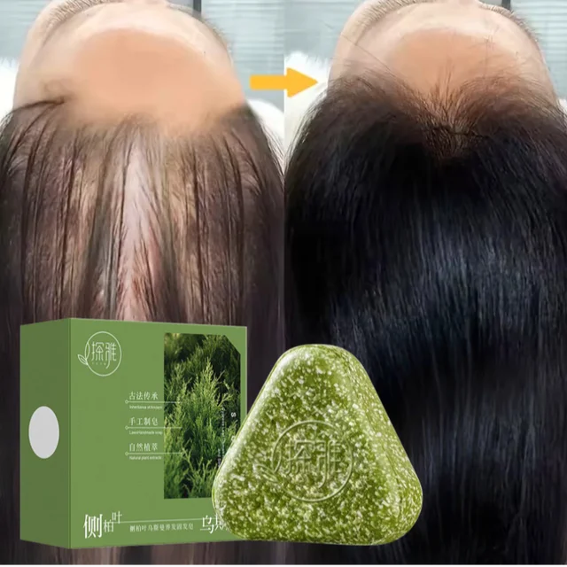 Shampoing à base de plantes naturelles, savon fait à la main, nourrissant, contrôle de l'huile, soin capillaire rafraîchissant, moelleux et apaisant 1