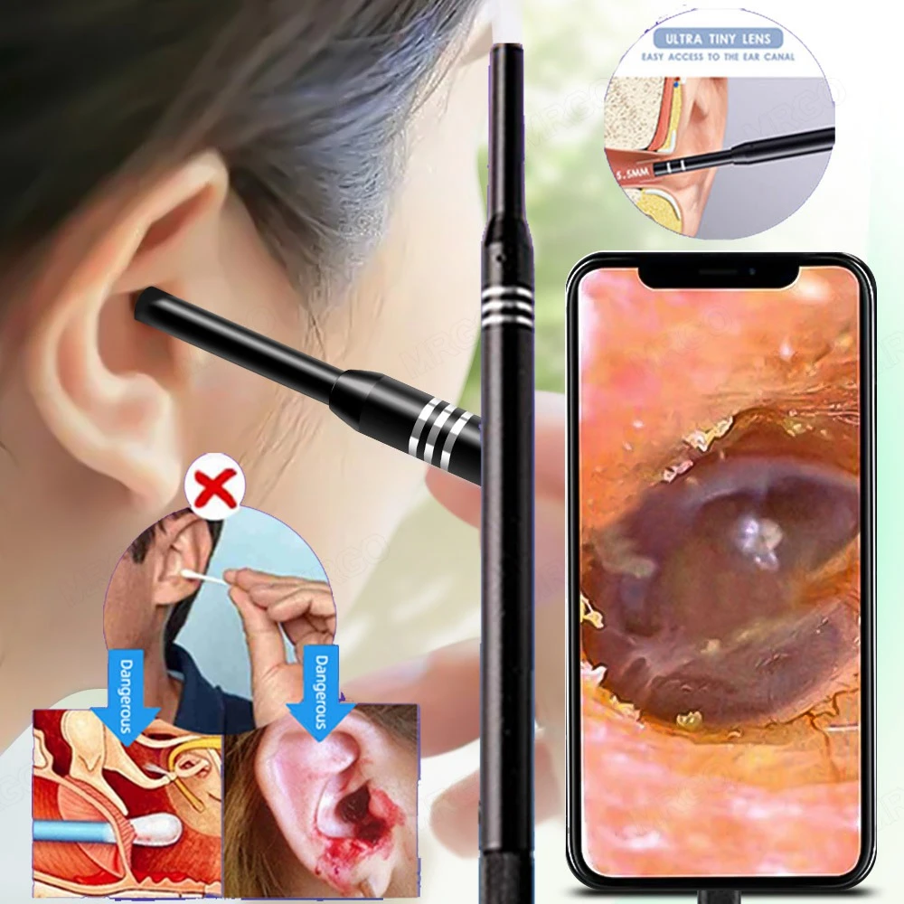 Clean Ear Endoscope Camera Mini Borescope Otoscope Mobile  for Cars Mobile Probe Micro Endoscopic for Smartphone Endoscope Usb C cctv camera set