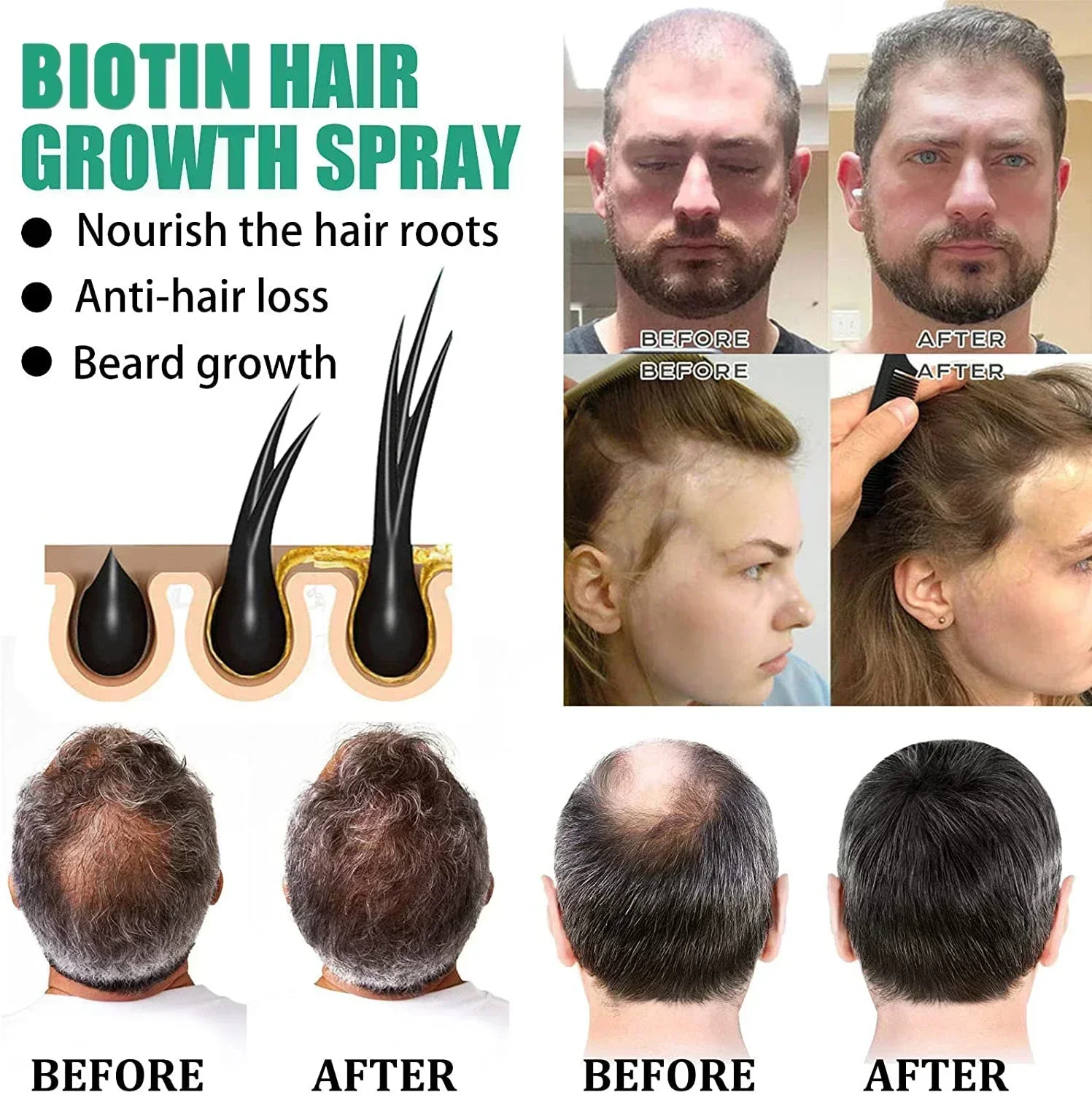Biotin Hair Spray for Man Women 20ml Repair Damage Restore Oil Scalp Repair Serum Thicken Hair Health Care, hair care products