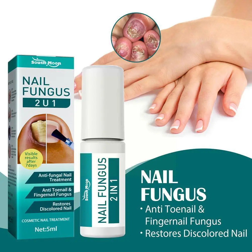 

Nail Fungal Cure Nail Fungus Removal Liquid Nutritious Paronychia Nail Fungal Onychomycosis Anti Repair Foot Repair Tools N L2S9