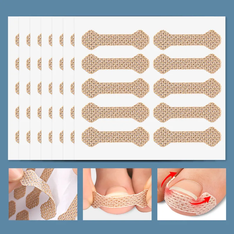 40/100pcs Nail Correction Stickers Ingrown Toenail Corrector Patches Treatment Recover Corrector Pedicure Care Tool 2