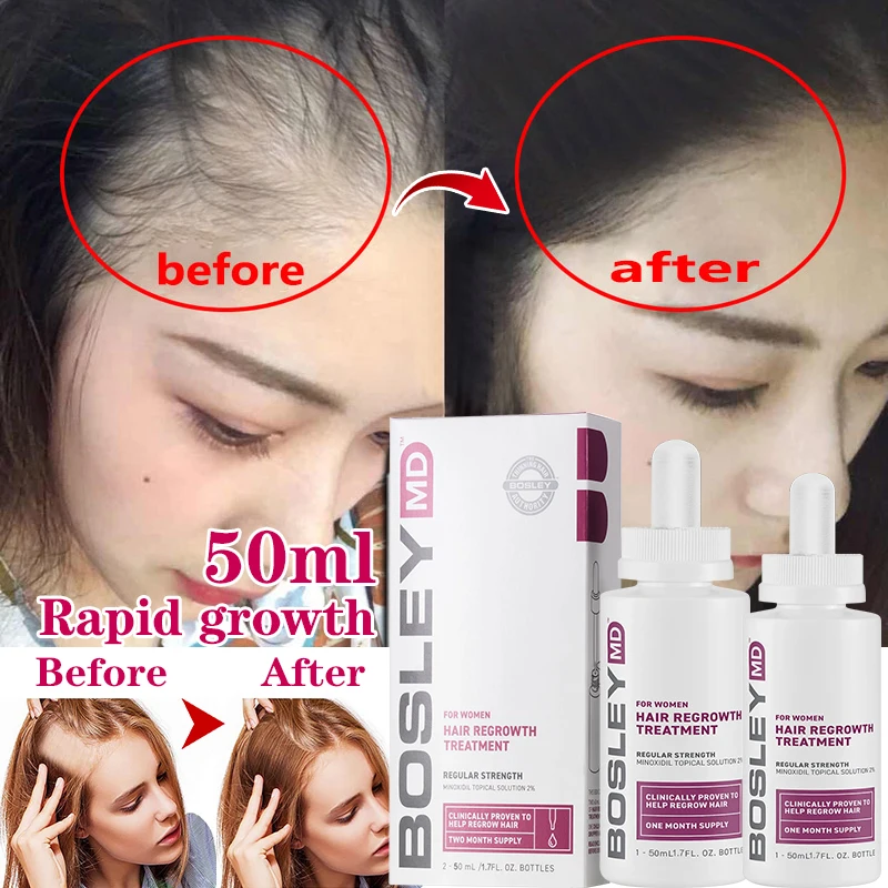 Hair Care Hair Growth Essential Oils Essence Original Authentic 100 Hair Loss Liquid Health