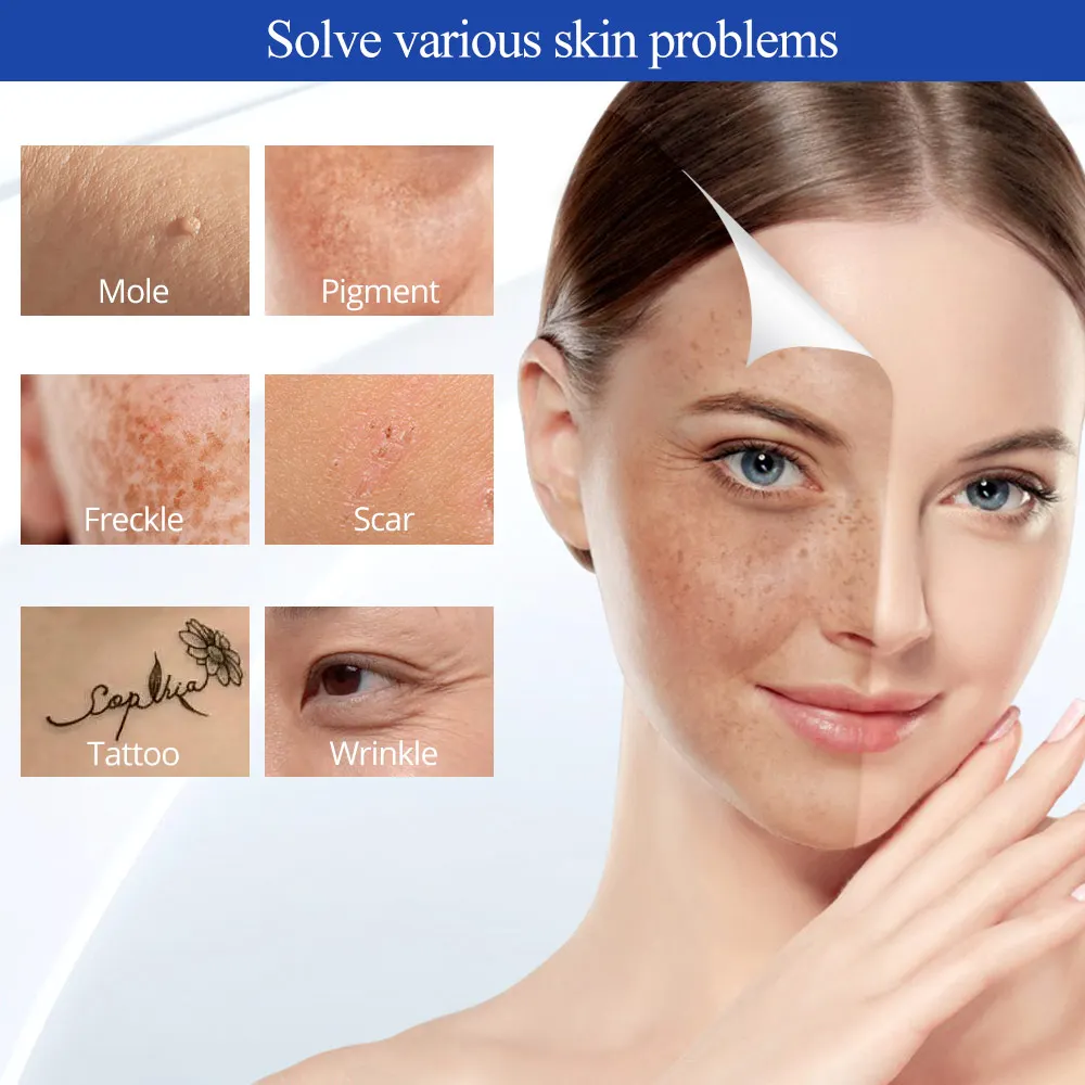 Plasma Pen Fibroblast for Eyelid Removal Wrinkle Sport Mole Acne Treat Skin Lift with Copper Needle Device plasma pen remover electrotherapy skin care tool laser plasma pen remover skin care device