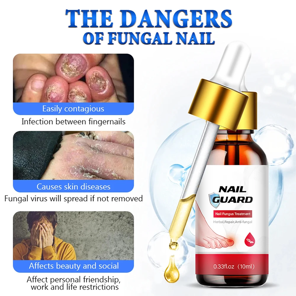 Laser Nail Fungus Treatment Device Repair Ingrown Toenail Fingernail Fungus Corrector Podiatry Mold Laser Nails with Mushrooms