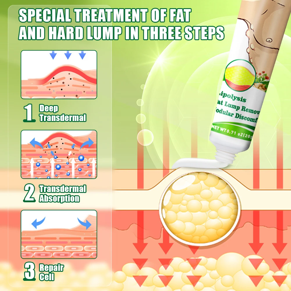 2Types Sumifun Lipoma Cream Remove Anti-tumor Fat Lump Nodular Ointment Skin Cyst Swelling Pain Relief Antibacterial Plaster