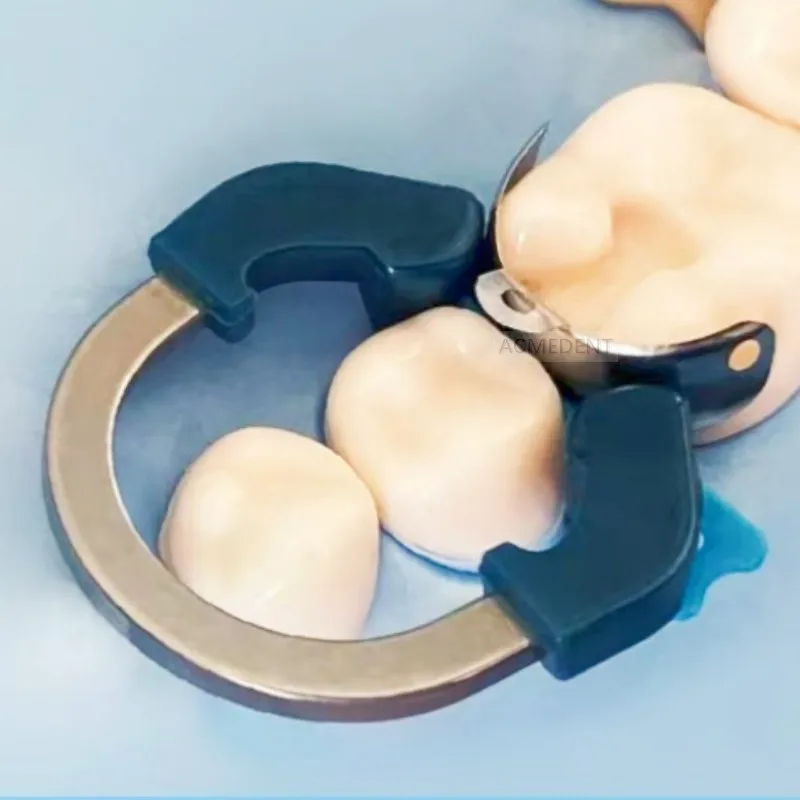 Pinze Per Filo Metallico Pinza Morsetto Per Sistema Matrice Sezionale Dentale Palodent V3 - Per Odontoiatri, Laboratori Pinza E Anello Per Restauri Dentali - Foto 2