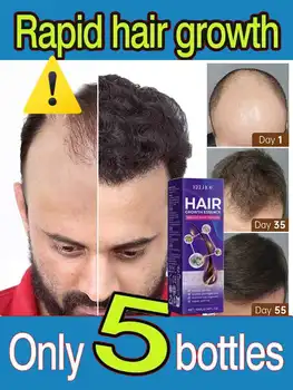 Hot selling product, 99% of buyers buy again, have more and more hair, say goodbye to baldness, thick hair